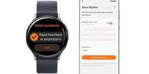 삼성전자 심전도 측정앱, 식약처의 의학장비 소프트웨어 허가받아