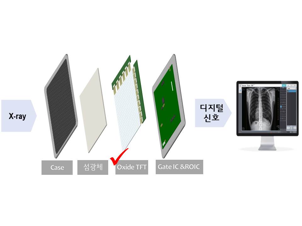 LG디스플레이 의료용 엑스레이 영상사업 진출, 2조 시장 공략