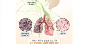 대웅제약 폐섬유증 후보물질, 미국 이어 유럽서도 희귀의약품 지정받아 