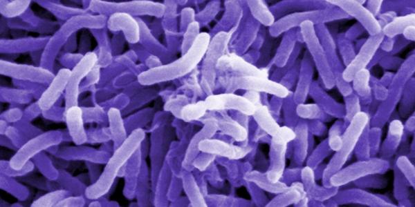 기후변화에 신종 콜레라 확산 우려, 국제연구진 