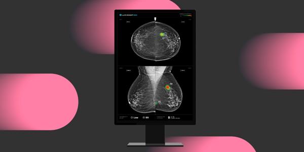 루닛 AI 유방촬영술 활용 네이처에 개재, 서범석 