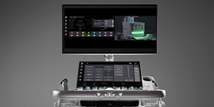 삼성메디슨 프리미엄 초음파 진단기기 'R20' 출시, 